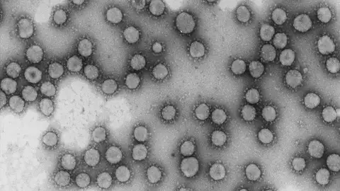 Ocho centros espanoles logran financiacion europea para investigar el coronavirus Ocho centros espanoles logran financiacion europea para investigar el coronavirus