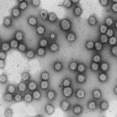Ocho centros espanoles logran financiacion europea para investigar el coronavirus