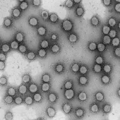Ocho centros espanoles logran financiacion europea para investigar el coronavirus Ocho centros espanoles logran financiacion europea para investigar el coronavirus