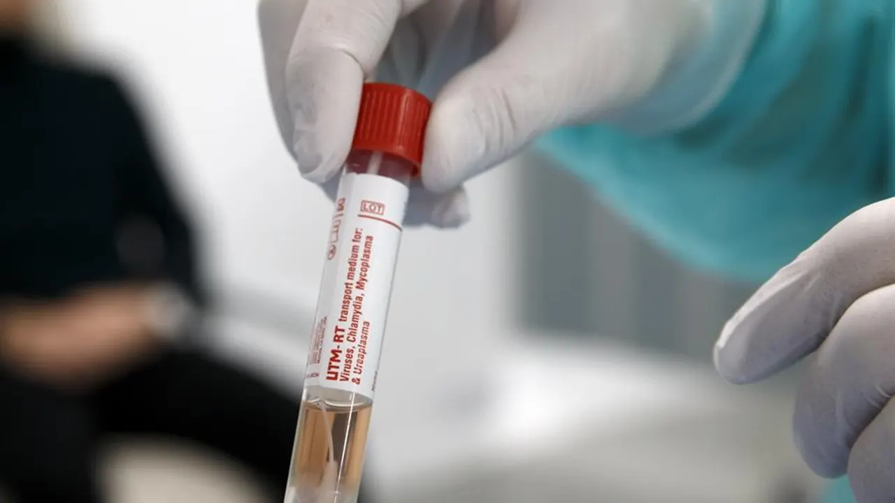Muestra de una persona sospechosa de estar infectada con el coronavirus