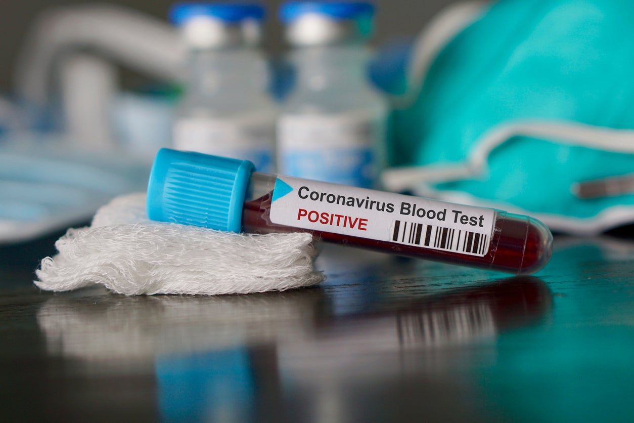 Dos nuevos casos de coronavirus en Segovia Dos nuevos casos de coronavirus en Segovia