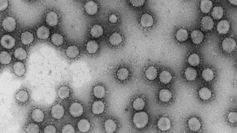 Resultado prometedor de un farmaco contra el mieloma que logra frenar un coronavirus humano Resultado prometedor de un farmaco contra el mieloma que logra frenar un coronavirus humano