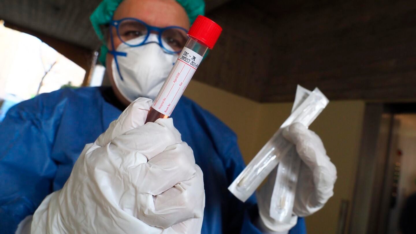 Prueba de diagnóstico del coronavirus