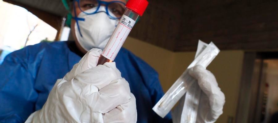 Prueba de diagnóstico del coronavirus Prueba de diagnóstico del coronavirus