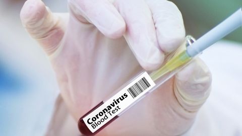 Cient&iacute;ficos alemanes establecen momento en que paciente ya no es contagioso