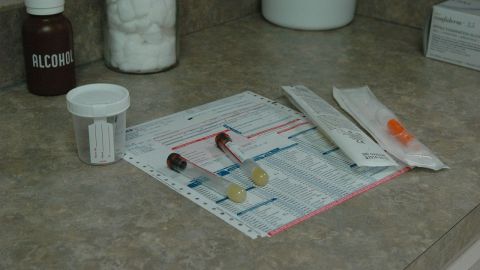 Prueba de orina y sangre