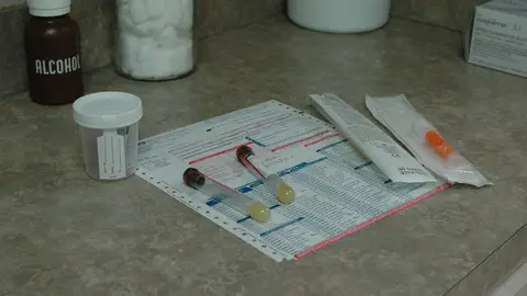 Prueba de orina y sangre Prueba de orina y sangre