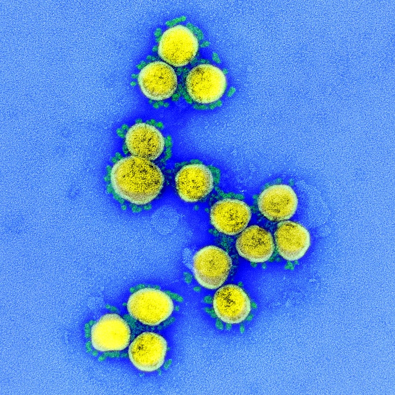 Repunte de los casos de coronavirus en Málaga Repunte de los casos de coronavirus en Málaga