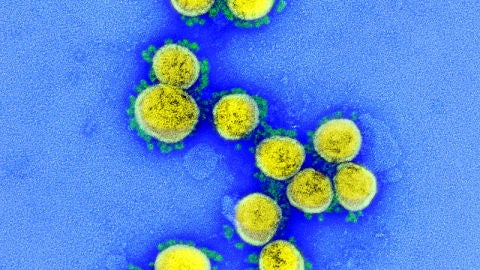 Im&aacute;genes del COVID-19