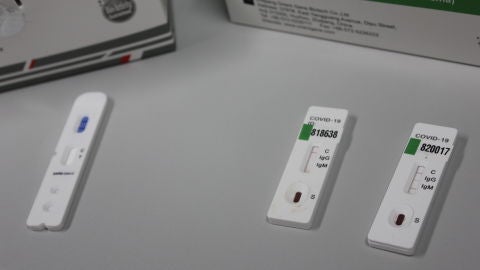 Reino Unido ofrece test gratuitos de coronavirus a las empresas para detectar contagios entre sus empleados