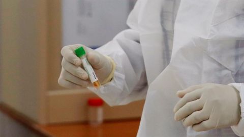 Pruebas en laboratorio de la vacuna contra el coronavirus