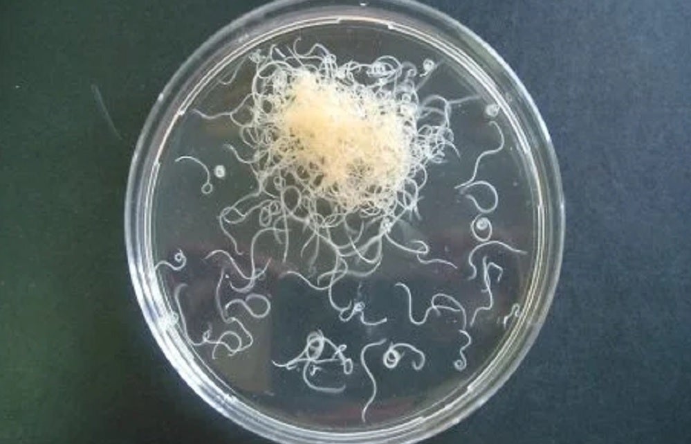 Qué pasa si comes un pescado con anisakis: alerta sanitaria de la UE Qué pasa si comes un pescado con anisakis: alerta sanitaria de la UE