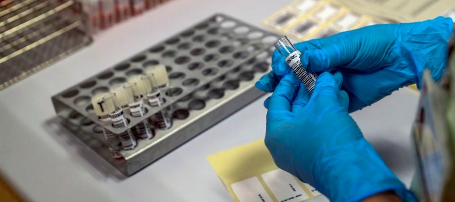 Estudio sobre el coronavirus Estudio sobre el coronavirus