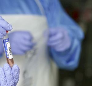 Un sanitario protegido con guantes sostiene un muestra para realizar un Análisis PCR Un sanitario protegido con guantes sostiene un muestra para realizar un Análisis PCR
