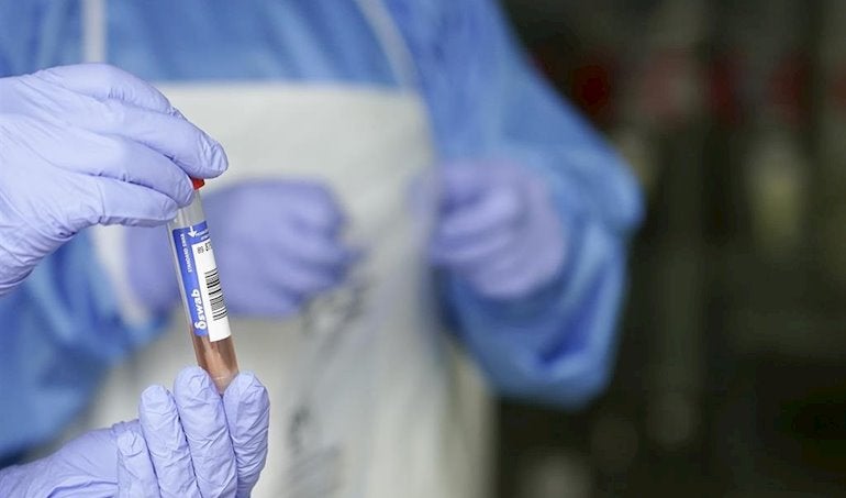 Tertulia de médicos: ¿Es más fiable la PCR rectal que el nasal? Tertulia de médicos: ¿Es más fiable la PCR rectal que el nasal?