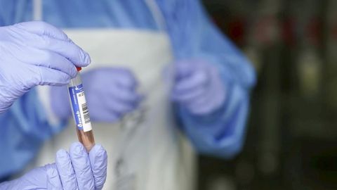 Un sanitario protegido con guantes sostiene un muestra para realizar un An&aacute;lisis PCR 