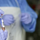 Un sanitario protegido con guantes sostiene un muestra para realizar un Análisis PCR Un sanitario protegido con guantes sostiene un muestra para realizar un Análisis PCR