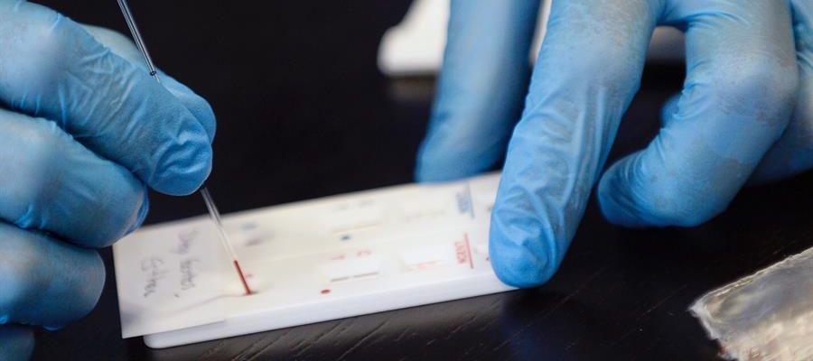 Los anticuerpos de un paciente recuperado del SARS podrían neutralizar de manera natural al coronavirus Los anticuerpos de un paciente recuperado del SARS podrían neutralizar de manera natural al coronavirus
