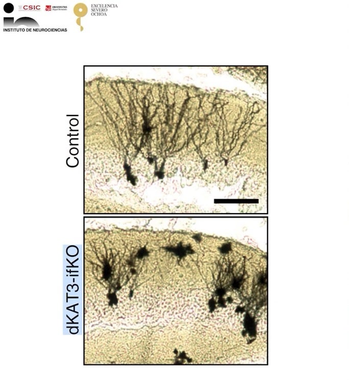 Una investigación del Instituto de Neurociencias de la UMH de Elche aclara las razones por las que una neurona mantiene su identidad toda la vida Una investigación del Instituto de Neurociencias de la UMH de Elche aclara las razones por las que una neurona mantiene su identidad toda la vida