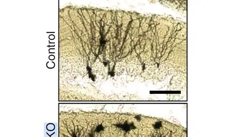 Estudio neuronas del Instituto de Neurociencias de la UMH. Estudio neuronas del Instituto de Neurociencias de la UMH.