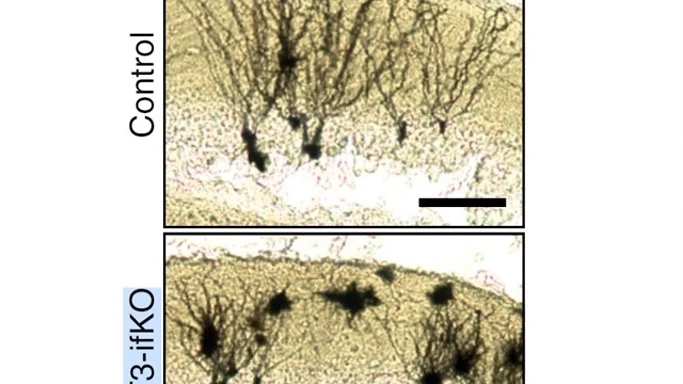Estudio neuronas del Instituto de Neurociencias de la UMH.