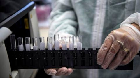 Un m&eacute;dico manipula unas muestras en un laboratorio