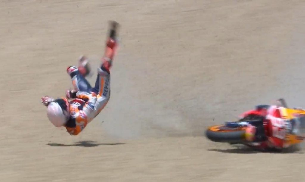 Marc Márquez será operado mañana tras fracturarse el húmero Marc Márquez será operado mañana tras fracturarse el húmero