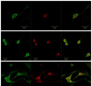 Distintas instantáneas de neuronas de ganglios raquídeos obtenidas mediante microscopía confocal. Distintas instantáneas de neuronas de ganglios raquídeos obtenidas mediante microscopía confocal.