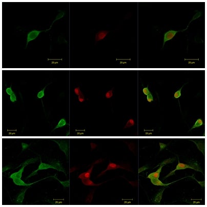 La Universidad Miguel Hernández de Elche busca tratar el dolor crónico mediante nanopartículas La Universidad Miguel Hernández de Elche busca tratar el dolor crónico mediante nanopartículas