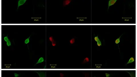 Distintas instantáneas de neuronas de ganglios raquídeos obtenidas mediante microscopía confocal. Distintas instantáneas de neuronas de ganglios raquídeos obtenidas mediante microscopía confocal.
