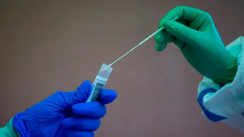 Pruebas PCR Pruebas PCR