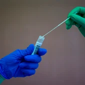 Pruebas PCR Pruebas PCR
