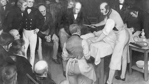 El cirujano Robert Liston El cirujano Robert Liston