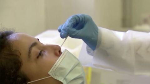 Anticuerpos del coronavirus
