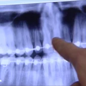Dentix Dentix