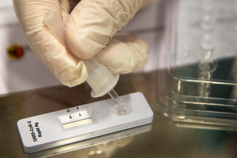 Madrid podrá realizar test de antígenos en las farmacias en zonas de alta incidencia Madrid podrá realizar test de antígenos en las farmacias en zonas de alta incidencia