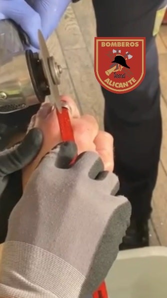Los bomberos del SPEIS cortan con una radial el anillo de un dedo inflamado por una picadura de avispa Los bomberos del SPEIS cortan con una radial el anillo de un dedo inflamado por una picadura de avispa