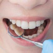 Los dentistas pueden detectar en la boca síntomas de la infección por VIH