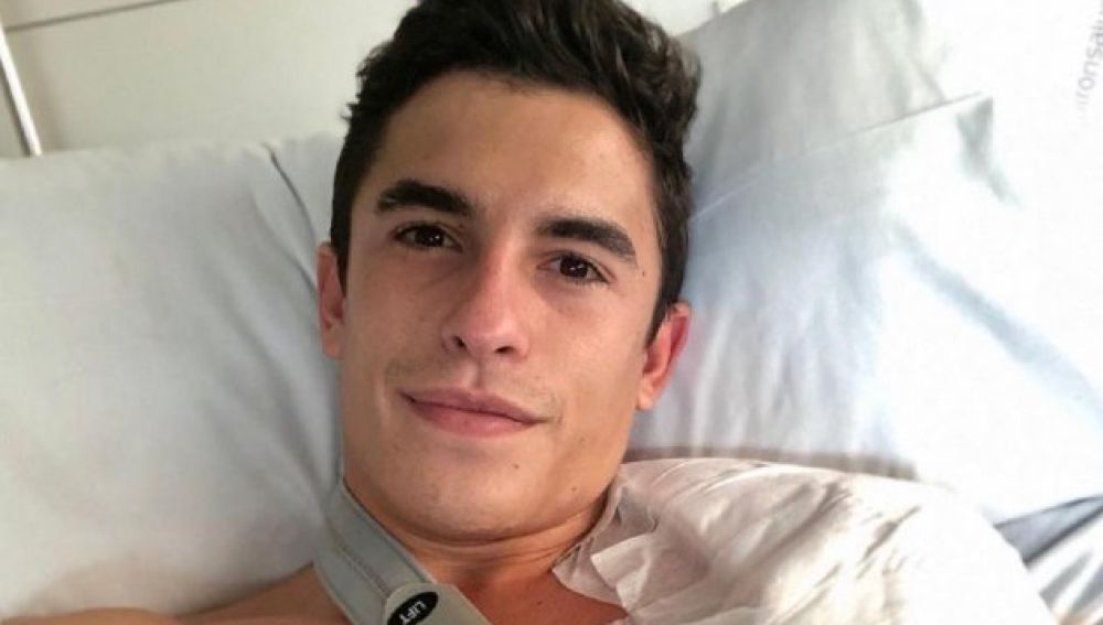 Marc Márquez, operado por tercera vez de su brazo derecho en una intervención de 11 horas Marc Márquez, operado por tercera vez de su brazo derecho en una intervención de 11 horas