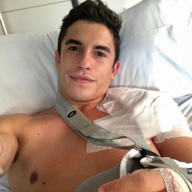 Marc Márquez seguirá ingresado por una infección en el húmero Marc Márquez seguirá ingresado por una infección en el húmero