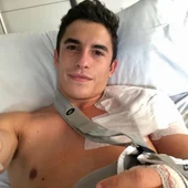 Marc Márquez, operado por tercera vez de su brazo derecho en una intervención de 11 horas Marc Márquez, operado por tercera vez de su brazo derecho en una intervención de 11 horas