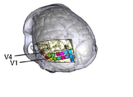 La UMH de Elche participa en el diseño de una neuroprótesis para ayudar a personas ciegas a percibir formas y letras La UMH de Elche participa en el diseño de una neuroprótesis para ayudar a personas ciegas a percibir formas y letras
