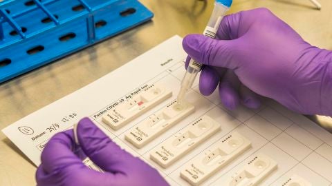 Test de ant&iacute;genos