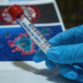 El Doctor José Gabriel Cano, director de salud pública de la Vega Baja nos ofrece datos de contagios, ingresos y vacunación El Doctor José Gabriel Cano, director de salud pública de la Vega Baja nos ofrece datos de contagios, ingresos y vacunación