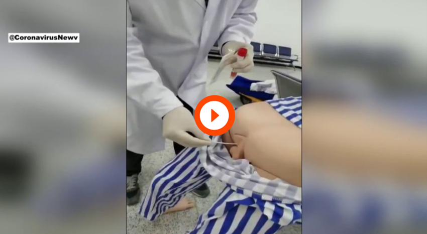 Así se hacen los test anales de detección de coronavirus: un sanitario chino lo explica en un vídeo Así se hacen los test anales de detección de coronavirus: un sanitario chino lo explica en un vídeo