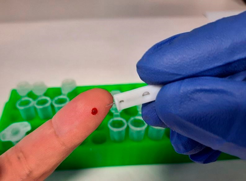 El CSIC desarrolla un test de coronavirus fiable casi al 99%: cómo funciona y cuándo estará disponible El CSIC desarrolla un test de coronavirus fiable casi al 99%: cómo funciona y cuándo estará disponible