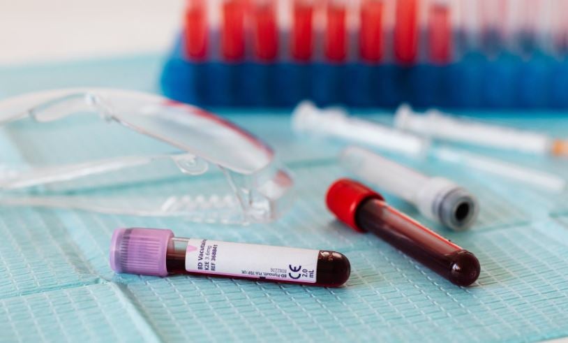 La Asociación de Donantes de Sangre del Sescam en Alcázar de San Juan realiza un llamamiento a la solidaridad La Asociación de Donantes de Sangre del Sescam en Alcázar de San Juan realiza un llamamiento a la solidaridad