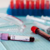 Madrid suma cerca de 230.000 donaciones de sangre durante 2020 Madrid suma cerca de 230.000 donaciones de sangre durante 2020