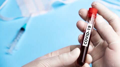 muestra de sangre para corona