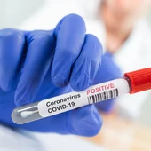 Positivo coronavirus Positivo coronavirus
